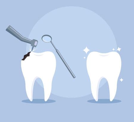 Cum salvezi un dinte pe care altădată îl pierdeai – opțiuni moderne în Oradea la Z Clinic